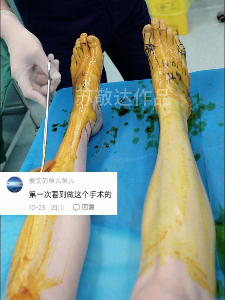 JJJ正式接受脚趾手术三个月后重新评估